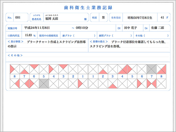 プラークチャート印刷